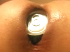 Anal insertion of a can