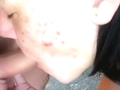 Girl with tons of zits sucks off her bf in nature